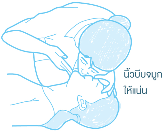 วิธีเป่าปากช่วยหายใจ