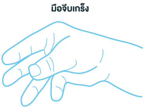 มือจีบเกร็ง