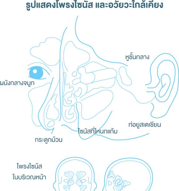 โพรงไซนัส และอวัยวะใกล้เคียง
