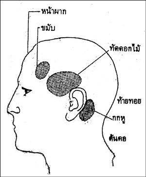 การตรวจรักษา อาการปวดหัว (ต่อ) - บทความสุขภาพ โดยมูลนิธิหมอชาวบ้าน